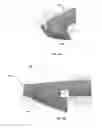 Fig. 10 - BONE REMOVAL UNDER DIRECT VISUALIZATION