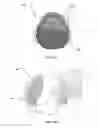 Fig. 11 - BONE REMOVAL UNDER DIRECT VISUALIZATION