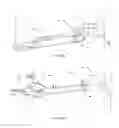 Fig. 19 - BONE REMOVAL UNDER DIRECT VISUALIZATION