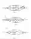 Fig. 02 - Delivery of thrombolytic agent through actuation member of thrombus retrieval device