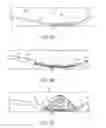 Fig. 04 - Delivery of thrombolytic agent through actuation member of thrombus retrieval device