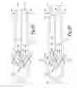 Fig. 08 - Combination medical device