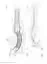 Fig. 12 - Surgical stapling device having supports for a flexible drive mechanism