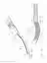 Fig. 15 - Surgical stapling device having supports for a flexible drive mechanism