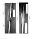 Fig. 21 - Atherectomy catheters and occlusion crossing devices