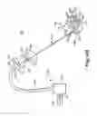 Fig. 09 - Device and method for removing bodily material