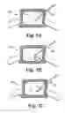 Fig. 11 - Device and method for removing bodily material