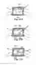 Fig. 14 - Device and method for removing bodily material