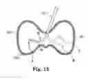 Fig. 15 - Device and method for removing bodily material