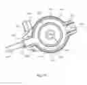 Fig. 11 - External fixation