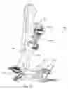Fig. 14 - External fixation
