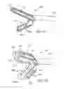 Fig. 16 - External fixation