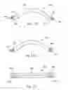 Fig. 18 - External fixation