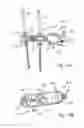 Fig. 19 - External fixation