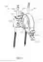 Fig. 23 - External fixation