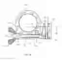 Fig. 27 - External fixation