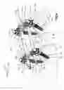Fig. 02 - Minimally invasive spinal fixation system including vertebral alignment features