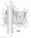 Fig. 06 - Minimally invasive spinal fixation system including vertebral alignment features