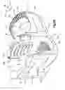 Fig. 07 - Minimally invasive spinal fixation system including vertebral alignment features
