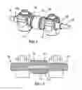 Fig. 03 - Flexible spine stabilization system