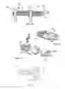 Fig. 22 - Flexible spine stabilization system