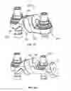 Fig. 28 - Flexible spine stabilization system