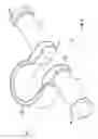 Fig. 04 - Dynamic spine stabilizers