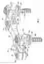 Fig. 05 - Dynamic spine stabilizers
