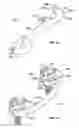 Fig. 11 - Dynamic spine stabilizers