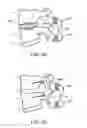 Fig. 05 - SURGICAL TETHER APPARATUS AND METHODS OF USE