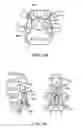 Fig. 07 - SURGICAL TETHER APPARATUS AND METHODS OF USE