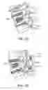 Fig. 11 - SURGICAL TETHER APPARATUS AND METHODS OF USE