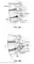 Fig. 12 - SURGICAL TETHER APPARATUS AND METHODS OF USE