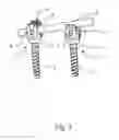 Fig. 02 - Surgical instrument for manipulating, positioning and fixing a surgical rod in relation to an implant