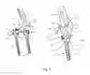Fig. 05 - Surgical instrument for manipulating, positioning and fixing a surgical rod in relation to an implant