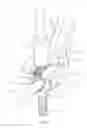 Fig. 07 - Surgical instrument for manipulating, positioning and fixing a surgical rod in relation to an implant