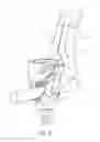 Fig. 10 - Surgical instrument for manipulating, positioning and fixing a surgical rod in relation to an implant