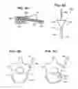 Fig. 06 - Flexible elongated chain implant and method of supporting body tissue with same
