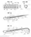 Fig. 08 - Flexible elongated chain implant and method of supporting body tissue with same