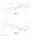 Fig. 05 - Method and apparatuses for angular and rotational correction of the femur