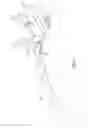 Fig. 09 - Method and apparatuses for angular and rotational correction of the femur