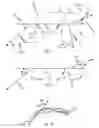 Fig. 04 - Fixed bone plate for rotational and translational first metatarsal osteotomy procedures