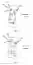 Fig. 05 - Fixed bone plate for rotational and translational first metatarsal osteotomy procedures