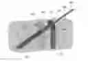 Fig. 01 - Fixation assembly and method of use