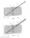 Fig. 11 - Fixation assembly and method of use