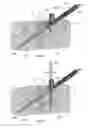 Fig. 12 - Fixation assembly and method of use