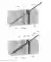 Fig. 13 - Fixation assembly and method of use