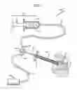 Fig. 02 - Tumor ablation system