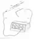Fig. 01 - Tapered precision blade electrosurgical instrument