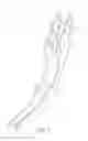 Fig. 08 - Manufacturing electrosurgical instruments
